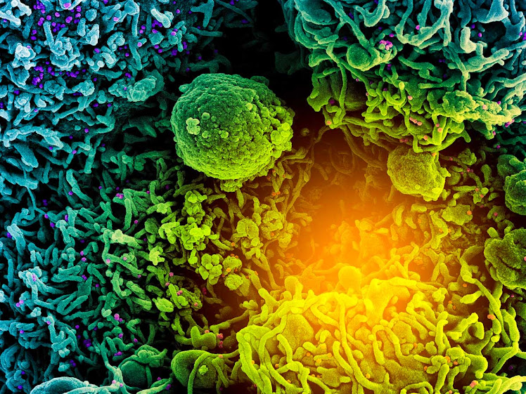 Descoberta facilita busca por remédio capaz de sabotar replicação do Sars-CoV-2