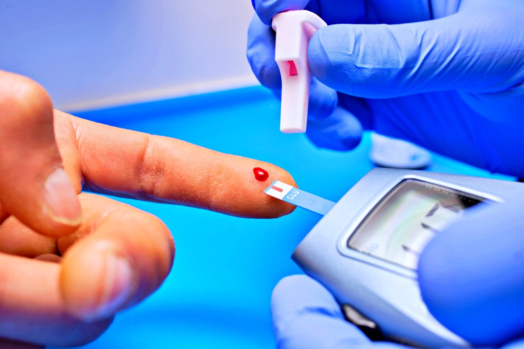 Tipo 5: nova classificação da diabetes acende alerta sobre impacto da&nbsp;desnutrição