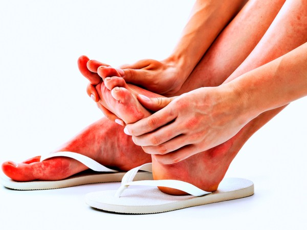 ‘Alergia à borracha’: o que é, e como&nbsp;lidar